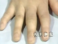 医学类视频 (414播放)